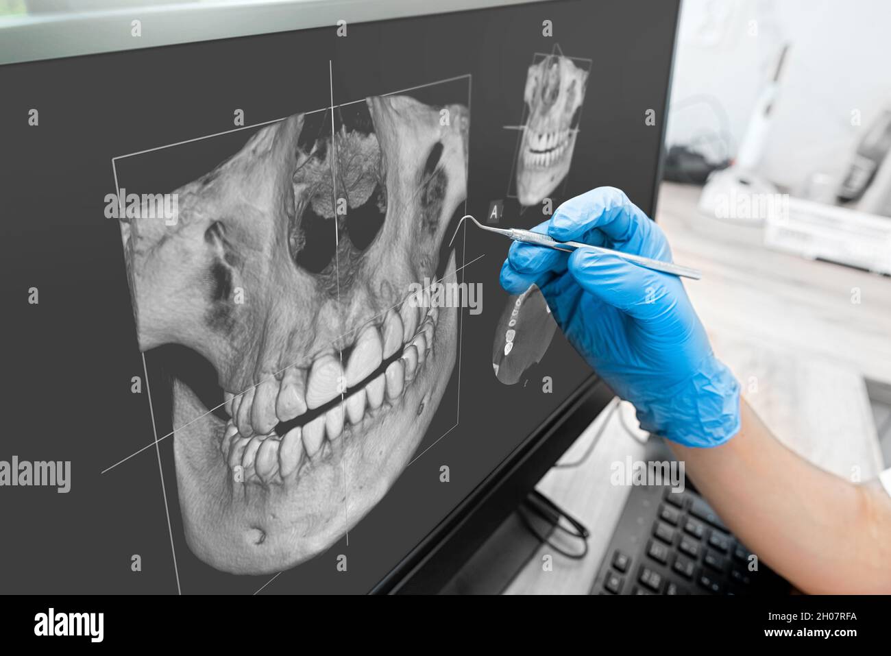 Médecin à la recherche de dents humaines x-ray sur écran d'ordinateur. Clinique dentaire moderne. Banque D'Images