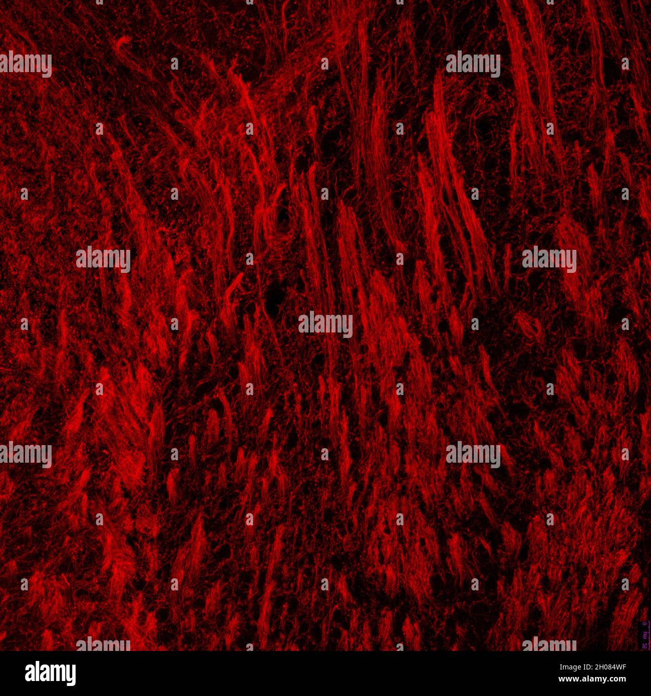 Section de la capsule interne du cerveau de la souris, avec processus oligodendrocytes marqués par immunofluorescence et visualisés au microscope confocal Banque D'Images