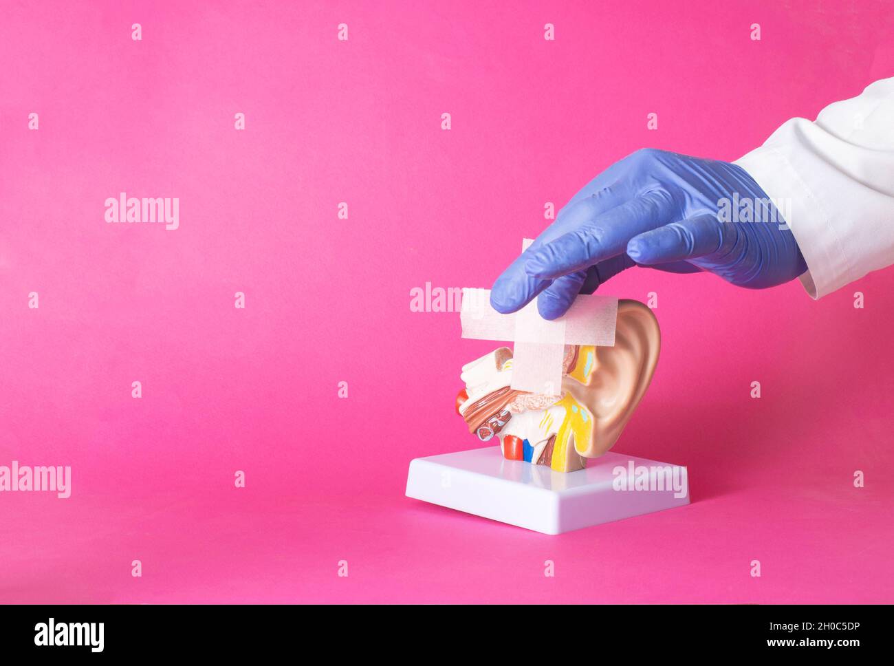 Le médecin colle un plâtre médical à la maquette de l'oreille humaine, fond  rose.Concept pour le traitement de la mycose des oreilles et des  acouphènes, co Photo Stock - Alamy