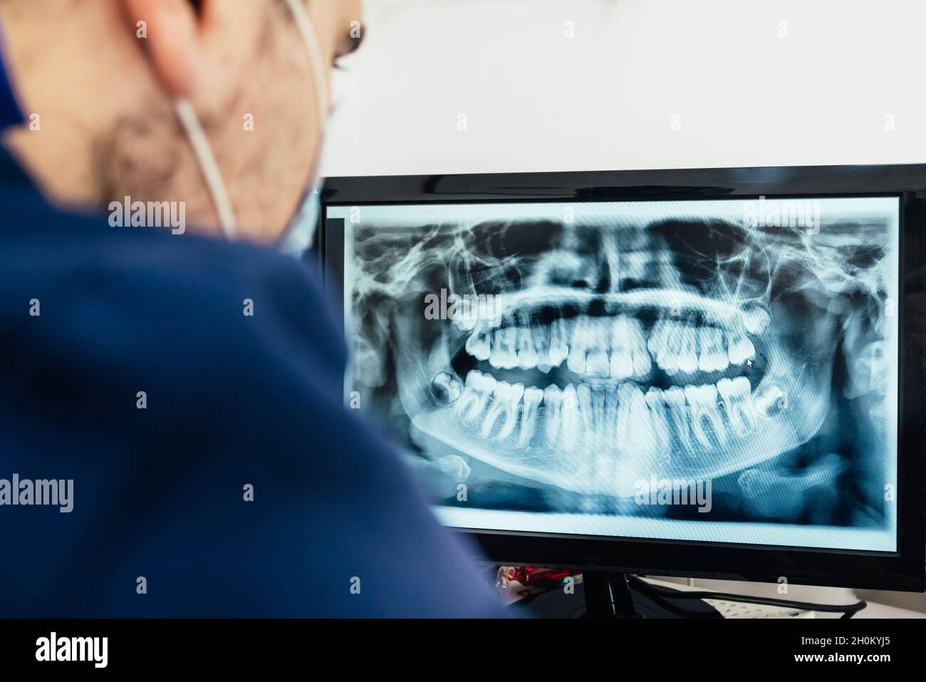 Dentiste médical examinant une radiographie panoramique sur un écran d'ordinateur dans une clinique dentaire. Banque D'Images