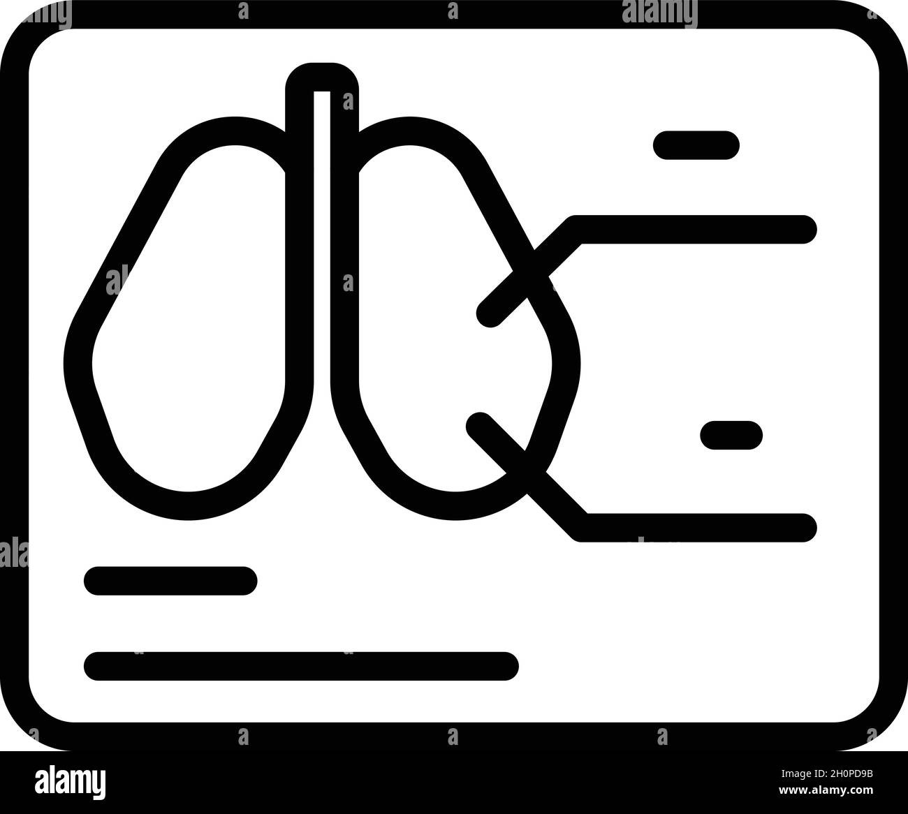 Vecteur de contour de l'icône d'image radiologique.Ordinateur patient.Poumon thoracique Illustration de Vecteur