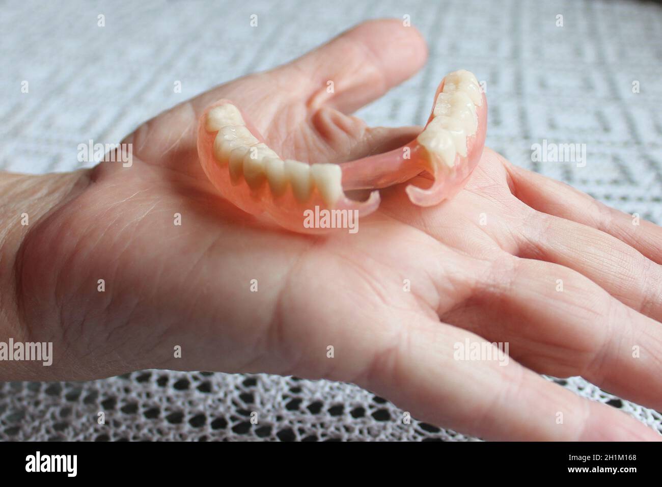 En nylon flexible prothèse sur la main des hommes. Dentiers amovibles souples, dépourvue de nylon, exempt de monomère hypoallergénique Banque D'Images