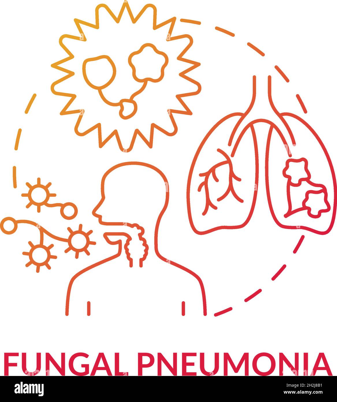 Icône de concept de gradient rouge de pneumonie fongique Illustration de Vecteur