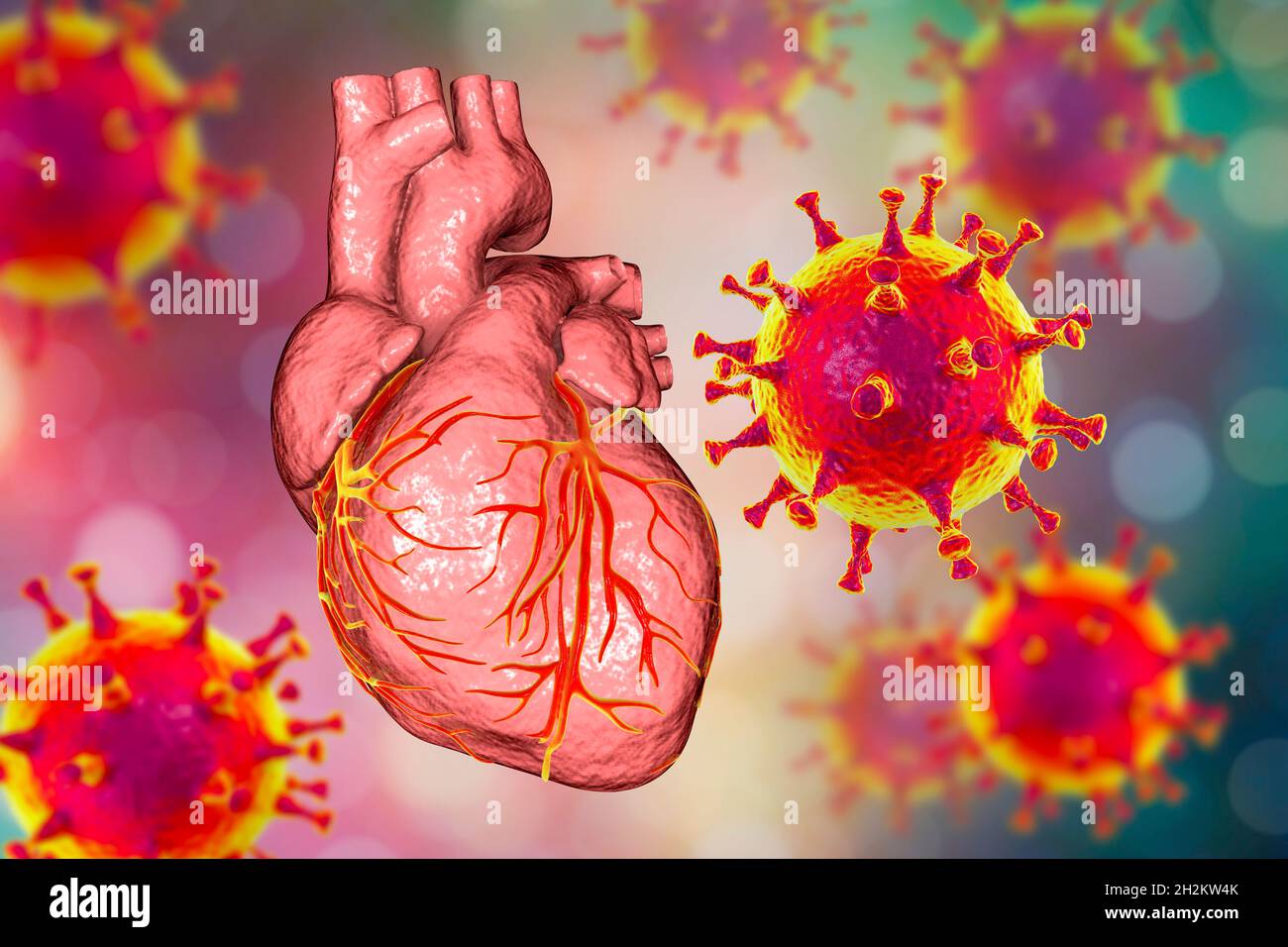 Virus Covid-19 affectant le cœur, illustration Banque D'Images