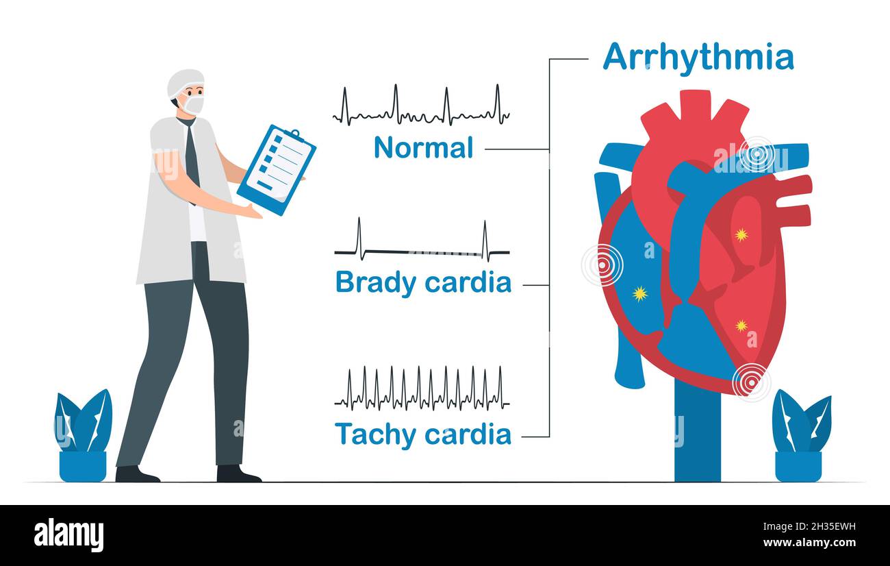 Le signal cardiaque normal est comparé à 2 types d