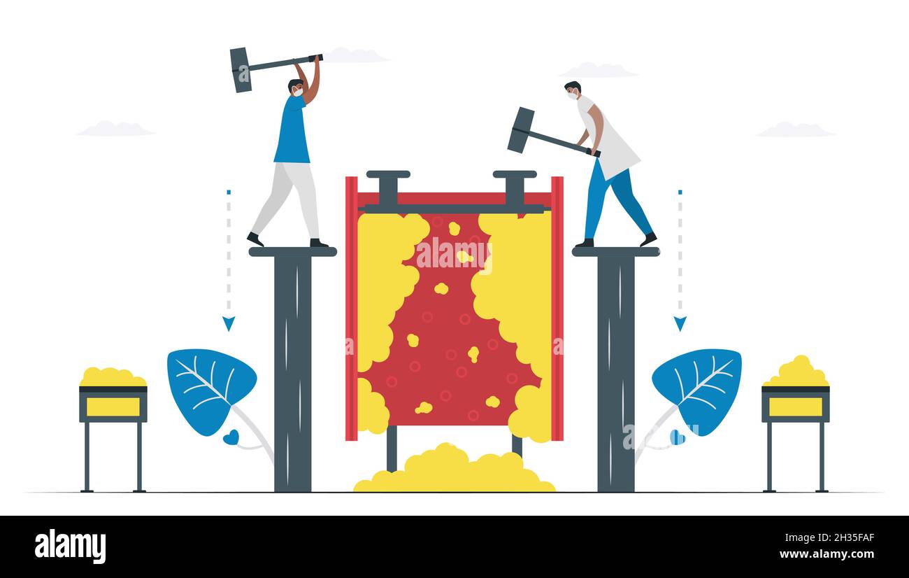 Les médecins retirent et nettoient la graisse dans les vaisseaux sanguins.Illustration vectorielle de cardiologie isolée sur fond blanc. Illustration de Vecteur