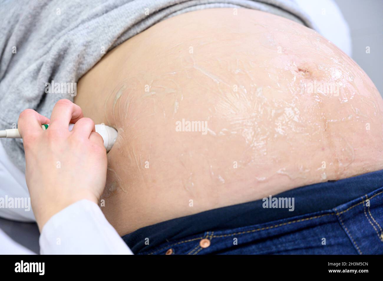 Le médecin fait l'échographie ou l'échographie procédure à une femme enceinte dans l'hôpital, gros plan de l'obstétricien en mouvement Trans Banque D'Images