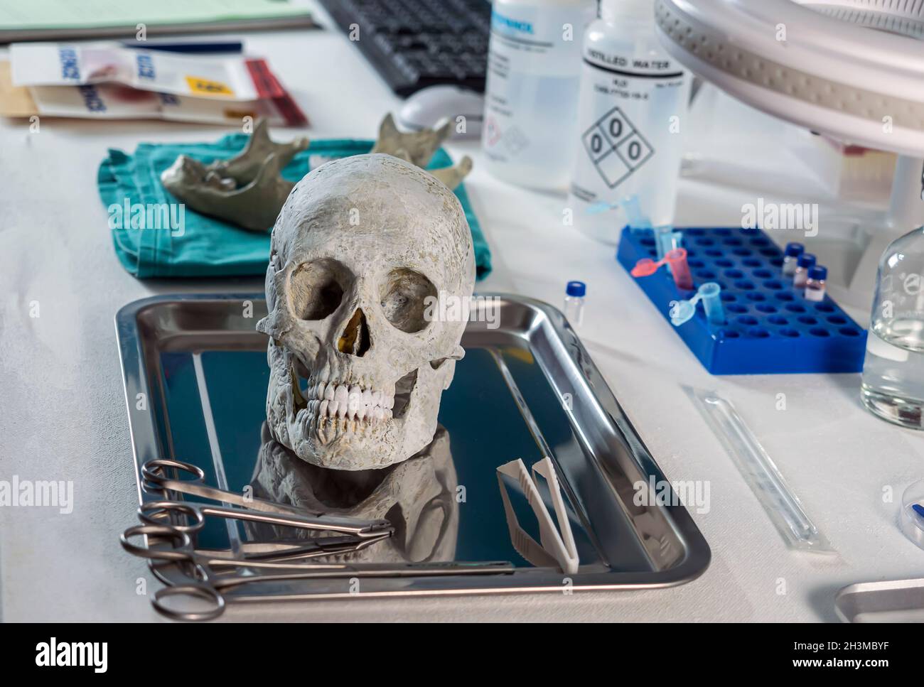 Crâne humain d'un adulte assassiné dans un laboratoire médico-légal, image conceptuelle Banque D'Images
