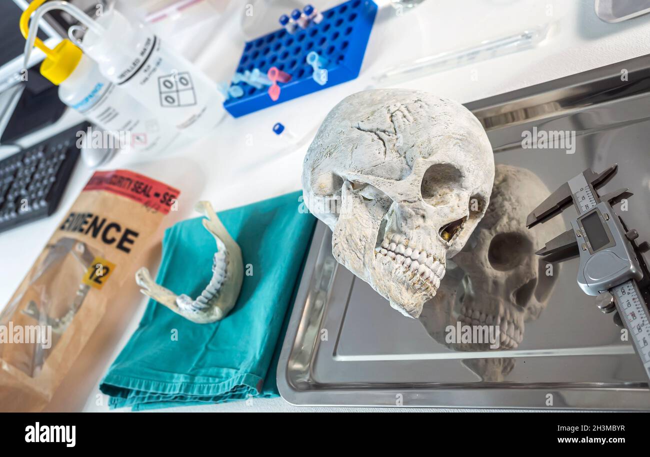Crâne humain d'un adulte assassiné dans un laboratoire médico-légal, image conceptuelle Banque D'Images