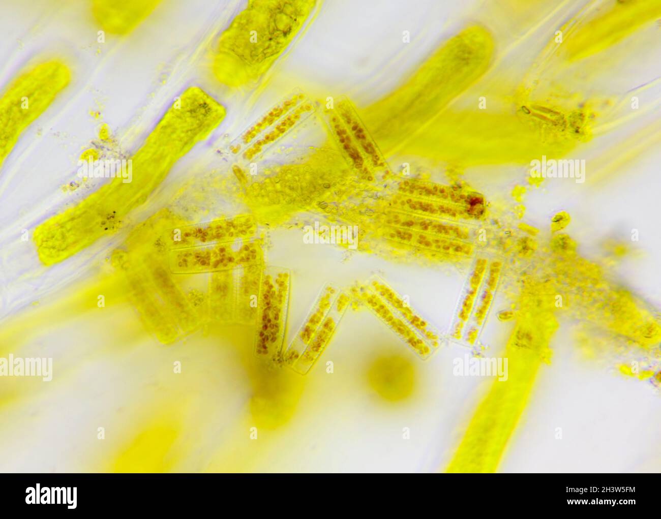 Vue microscopique d'un diatomé (Diatoma) entre les cellules d'algues.Éclairage à fond clair. Banque D'Images