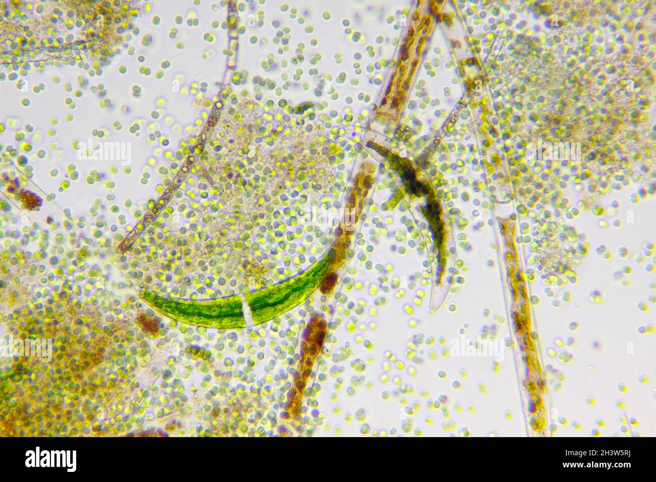 Vue microscopique de différents types d'algues.Éclairage à fond clair. Banque D'Images