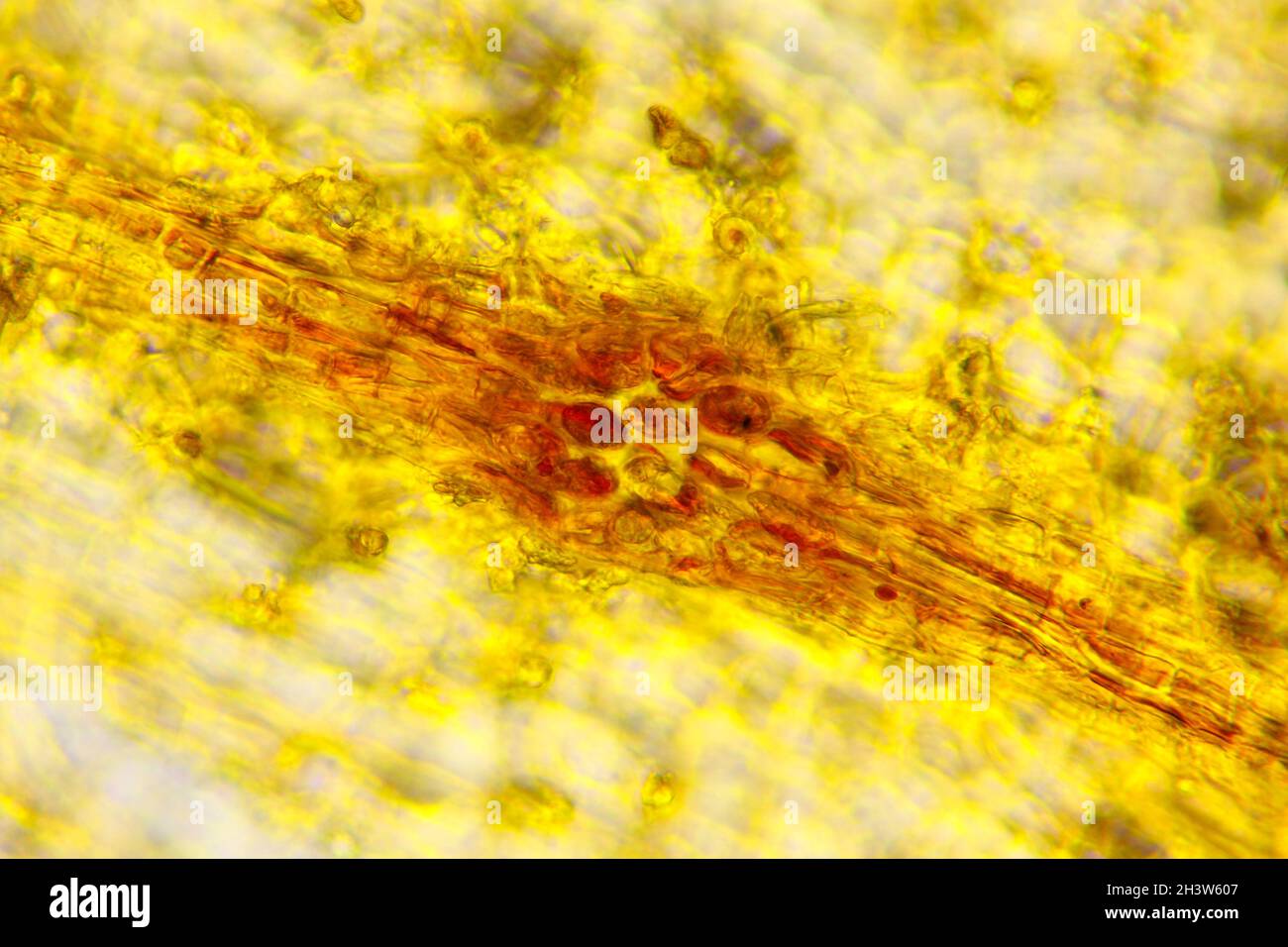 Vue microscopique du zèle commun (Corylus avellana) lenticel (vue de dessus).Lumière transmise.Éclairage à fond clair. Banque D'Images