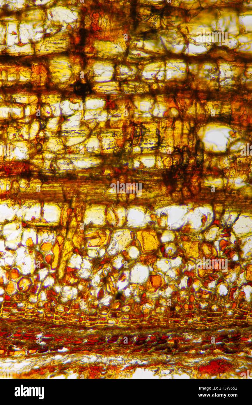 Vue microscopique de la section d'écorce du pin sylvestre (Pinus sylvestris).Éclairage à fond clair. Banque D'Images