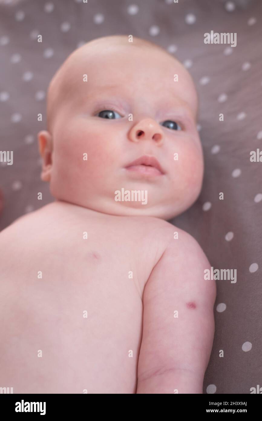 Vaccin g Banque D Image Et Photos Alamy