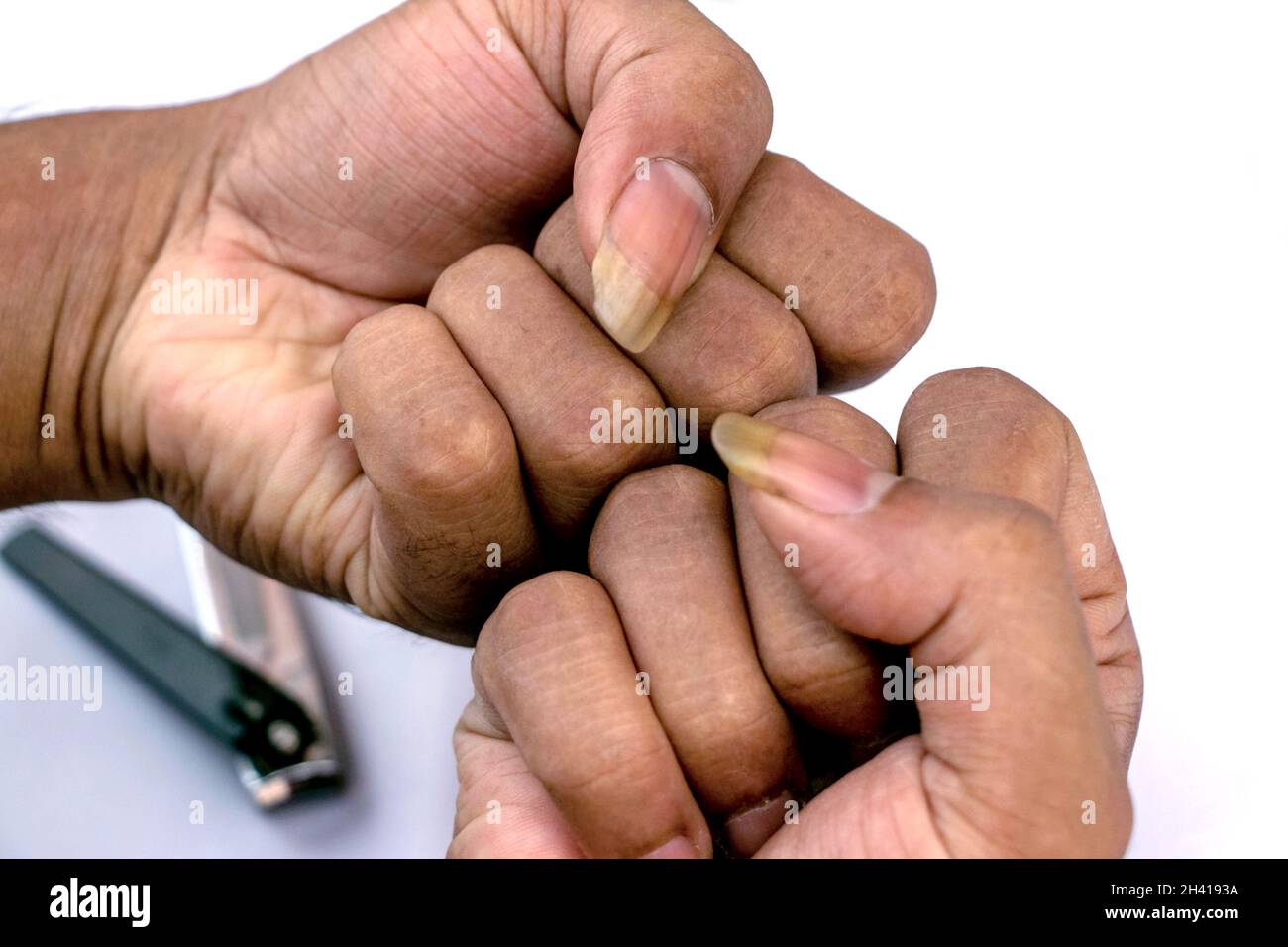 Un homme montrant ses ongles grands et sales sur fond blanc Banque D'Images