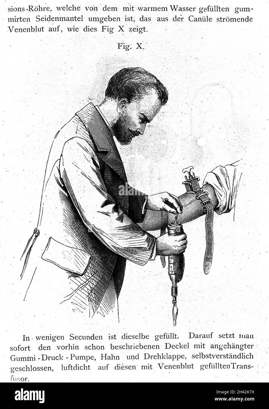 F. Gesellius, Die transfusion of blutes, transfusion sanguine Banque D'Images
