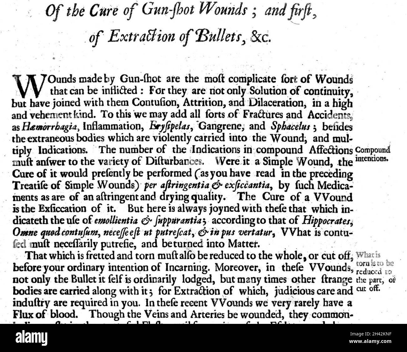 Wiseman 'traités chirurgicals', 1686: Blessures par balle Banque D'Images