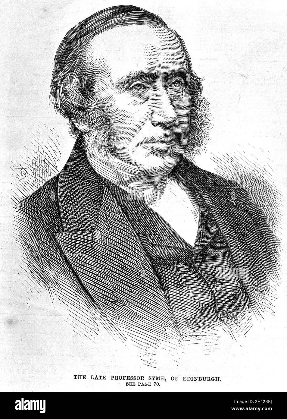 Portrait de James Syme. Banque D'Images