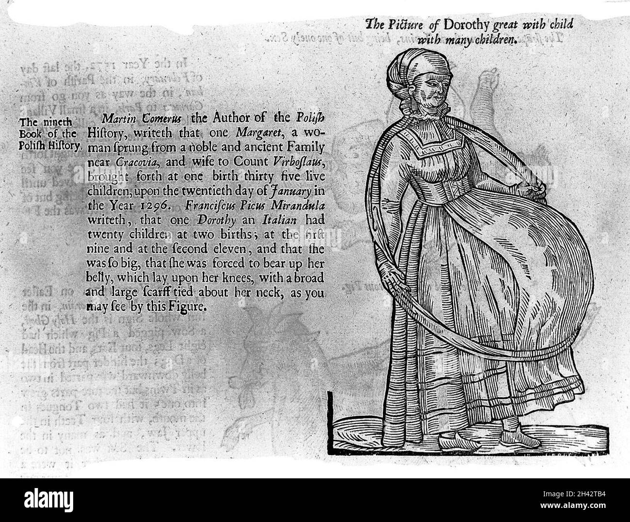 Femme enceinte avec neuf ou onze bébés. Banque D'Images