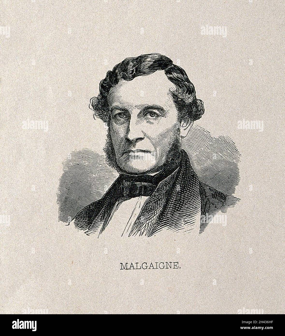 Joseph-François Malgaigne.Gravure en bois. Banque D'Images Joseph-François Malgaigne.Gravure en bois. Banque D'Images