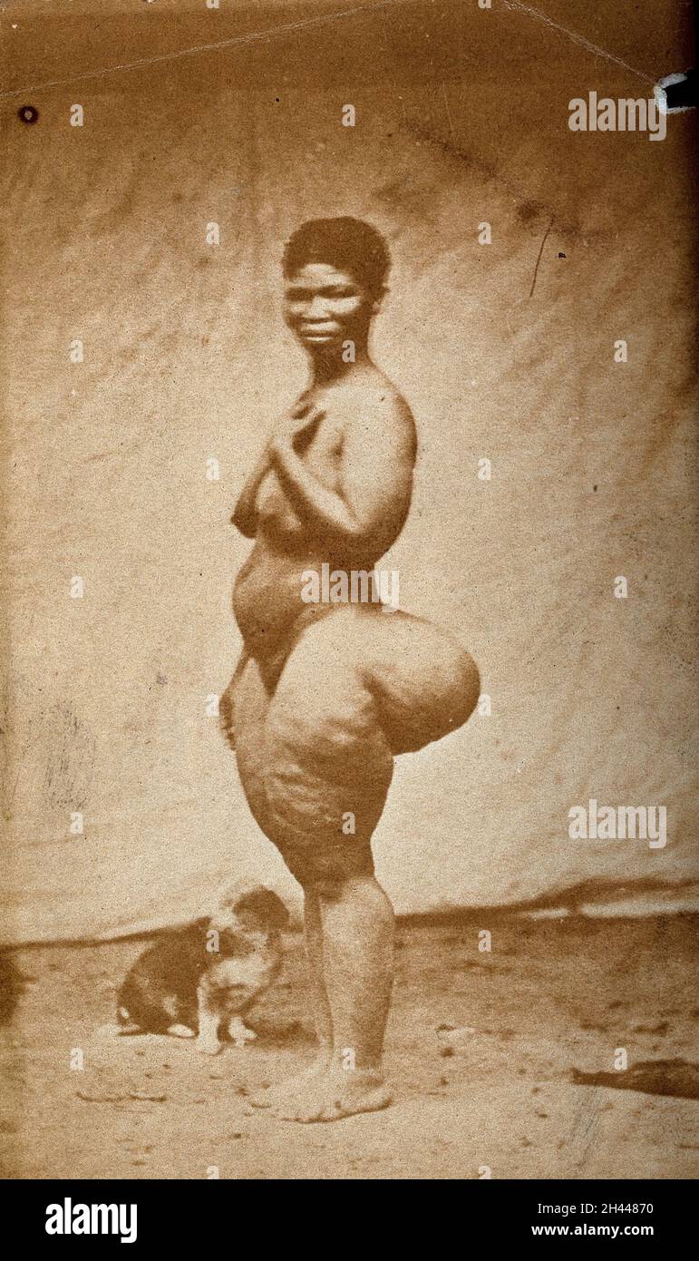 Femme debout, pleine vue latérale, avec agrandissement des fesses (stéatopygia).Photographie. Banque D'Images