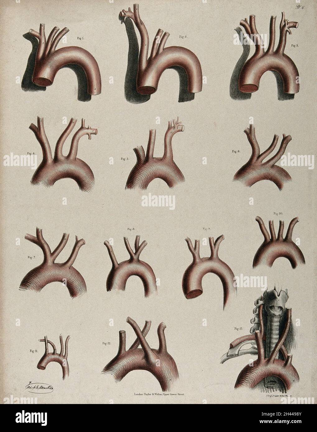 Le système circulatoire dissection de la crosse aortique (?), treize