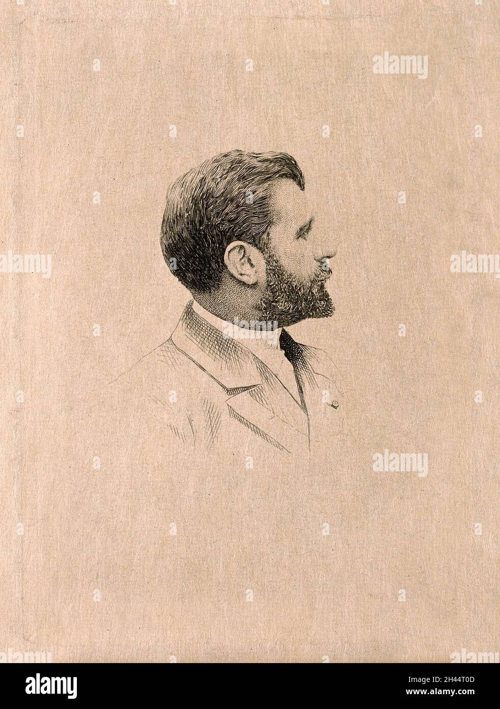 Samuel Pozzi.Gravure. Banque D'Images