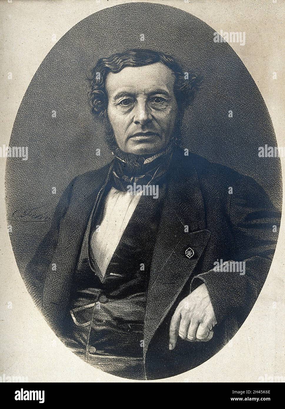 Joseph-François Malgaigne.Photographie après une lithographie. Banque D'Images Joseph-François Malgaigne.Photographie après une lithographie. Banque D'Images