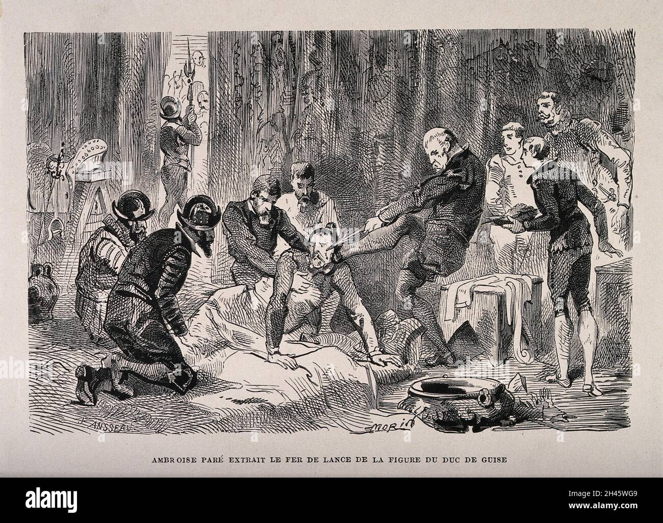 Ambroise Paré, en retirant la tête d'une lance de la face du Duc de guise.Gravure de bois par J. Ansseau après E. Morin. Banque D'Images