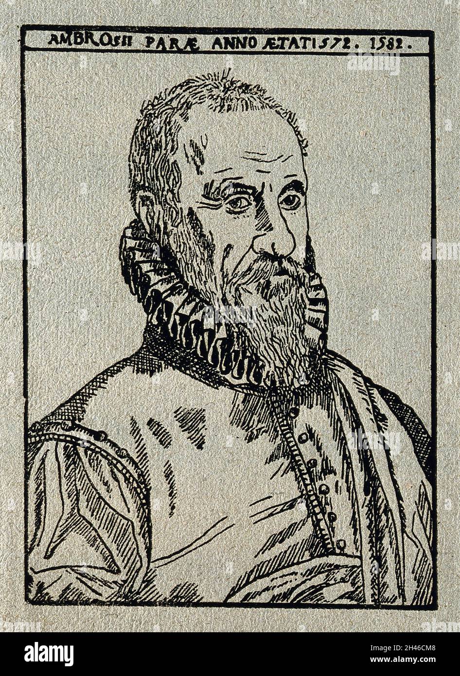Ambroise Paré.Reproduction de la coupe de bois d'après S. Delaulne, 1582. Banque D'Images