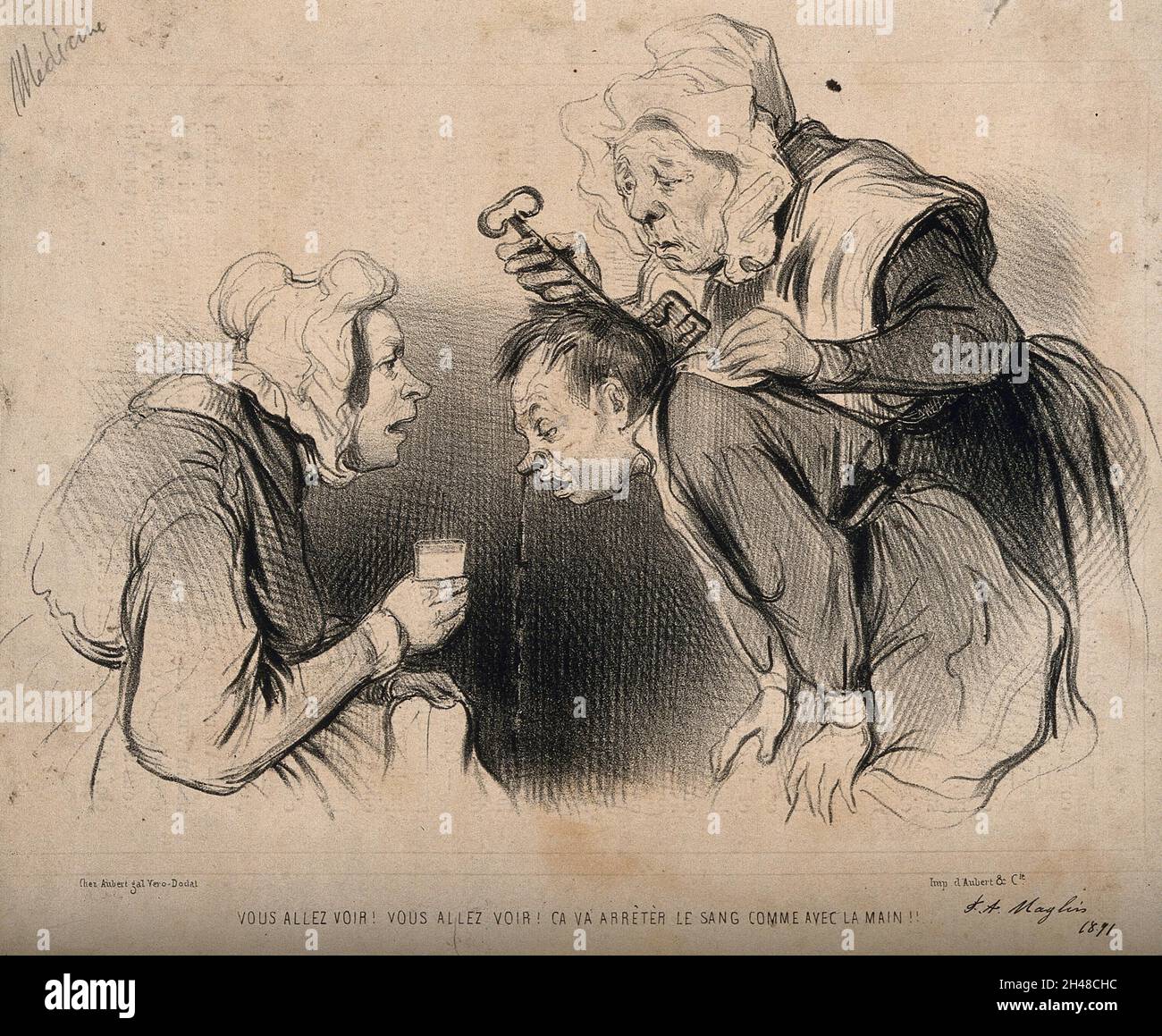 Une femme de ménage met une clé sur la chemise d'un homme pour arrêter son nez.Lithographie, c.1835-1841. Banque D'Images