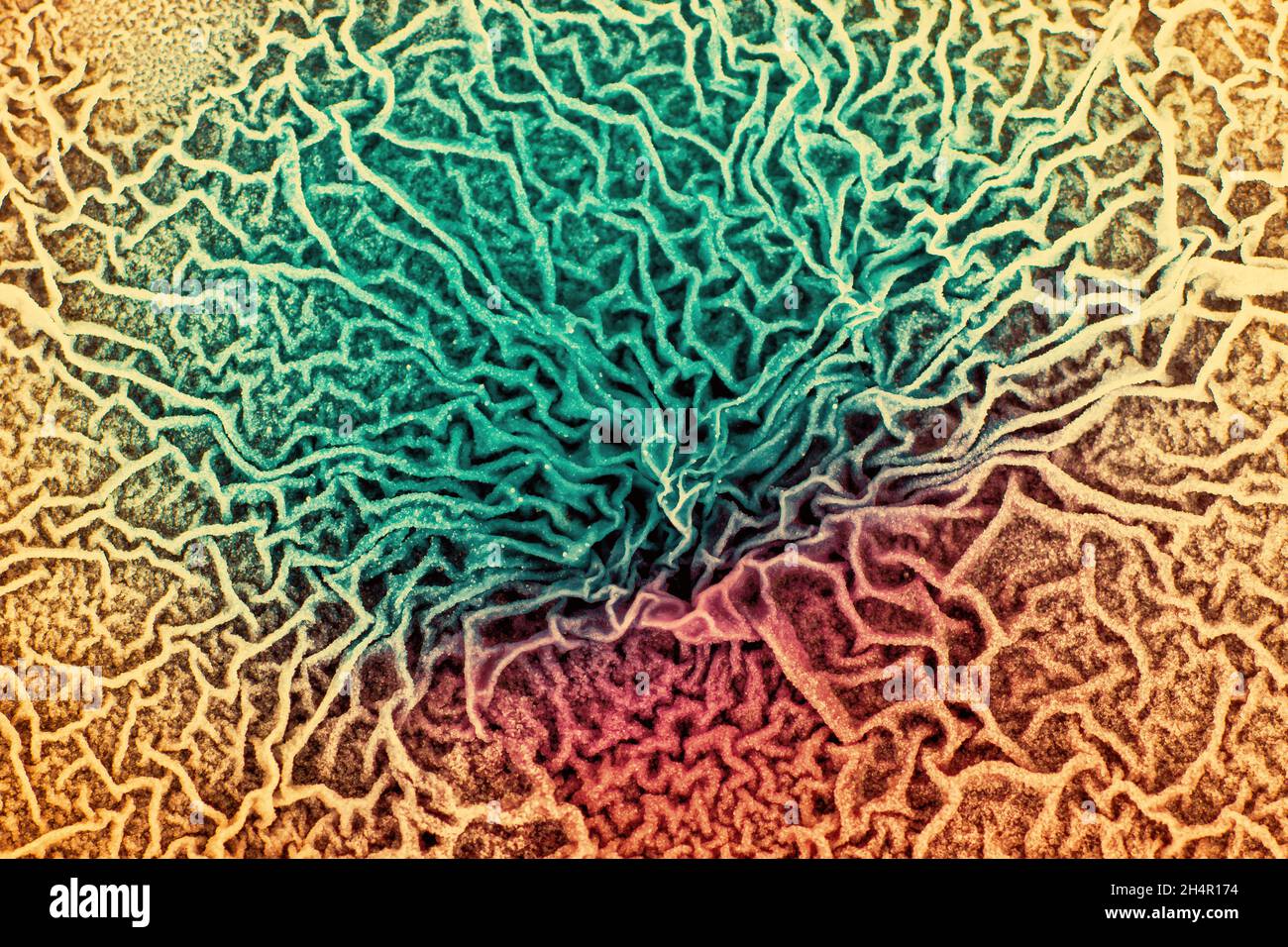 Le tissu d'un organisme biologique est affecté par deux types de cellules cancéreuses. Microscopie électronique. Image conceptuelle des processus de mutation sous l'inf Banque D'Images