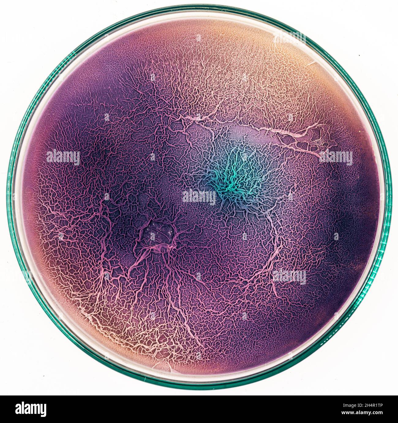 La surface du tissu biologique infecté par des micro-organismes pathogènes Banque D'Images