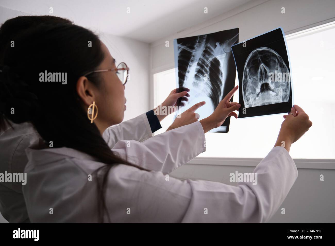 Deux médecins examinant un crâne et des images radiologiques de côtes. Banque D'Images