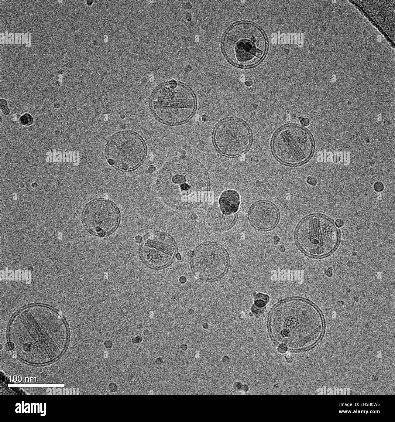 Micrographe de nanoparticules de lipides contenant un médicament anticancéreux Banque D'Images