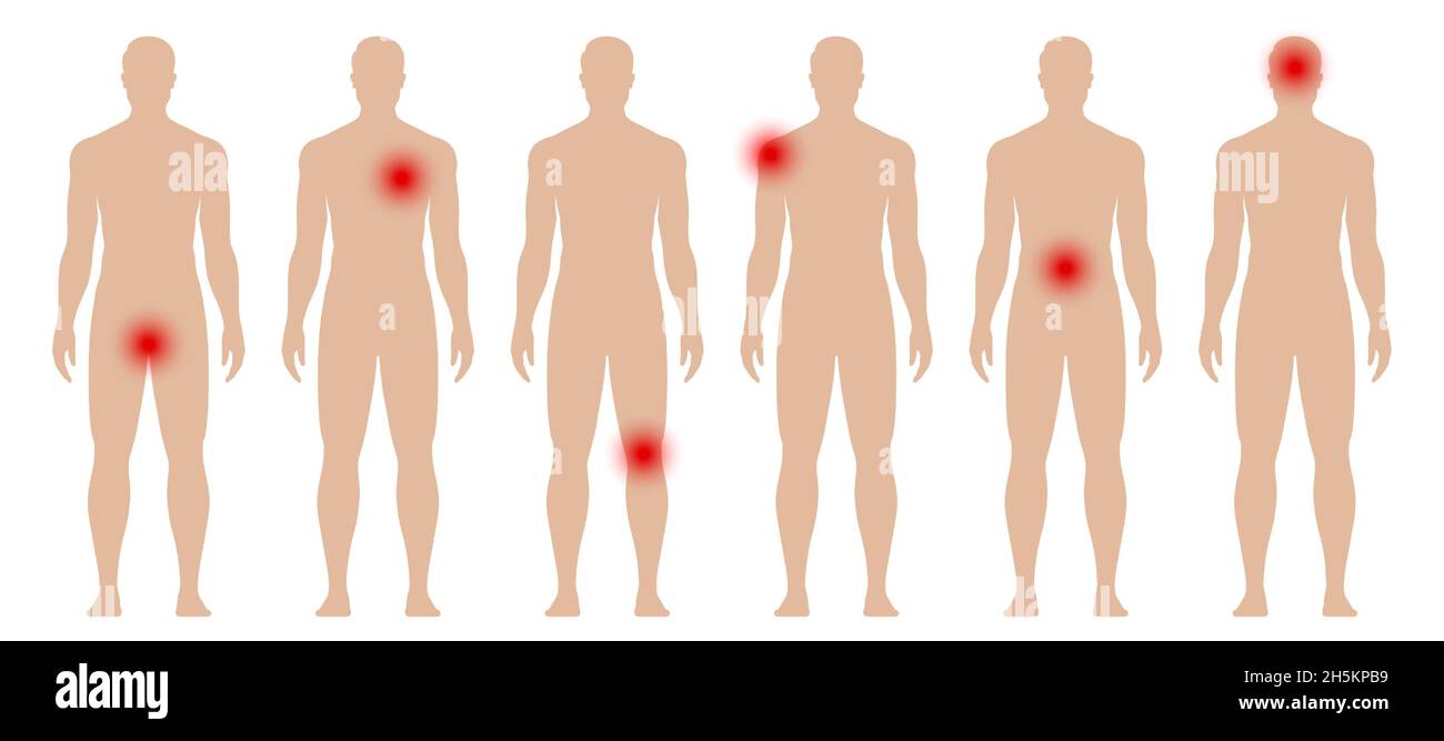 Silhouette d'homme avec des points rouges dans différentes parties du corps.Illustration du vecteur médical Aches and pains. Illustration de Vecteur