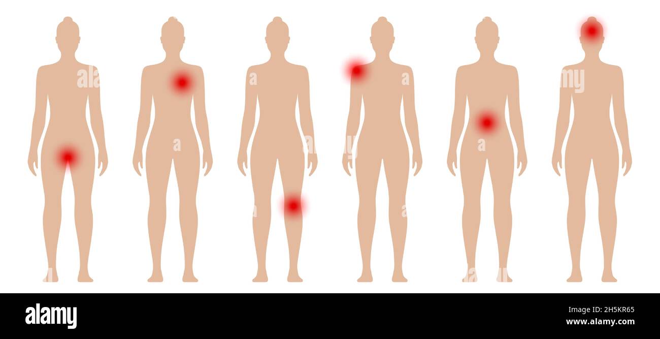 Silhouette de femme avec des points rouges dans différentes parties du corps.Illustration vectorielle des douleurs et des douleurs féminines. Illustration de Vecteur