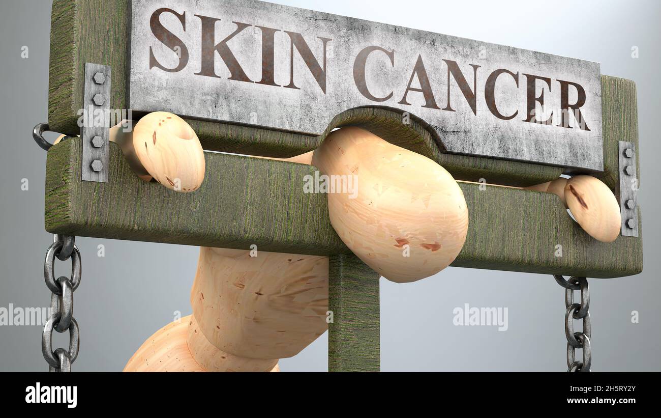 L'impact du cancer de la peau et l'influence sociale se présentent sous la forme d'une figure en pilori pour décrire l'effet du cancer de la peau sur la santé humaine et son importance et son fardeau Banque D'Images