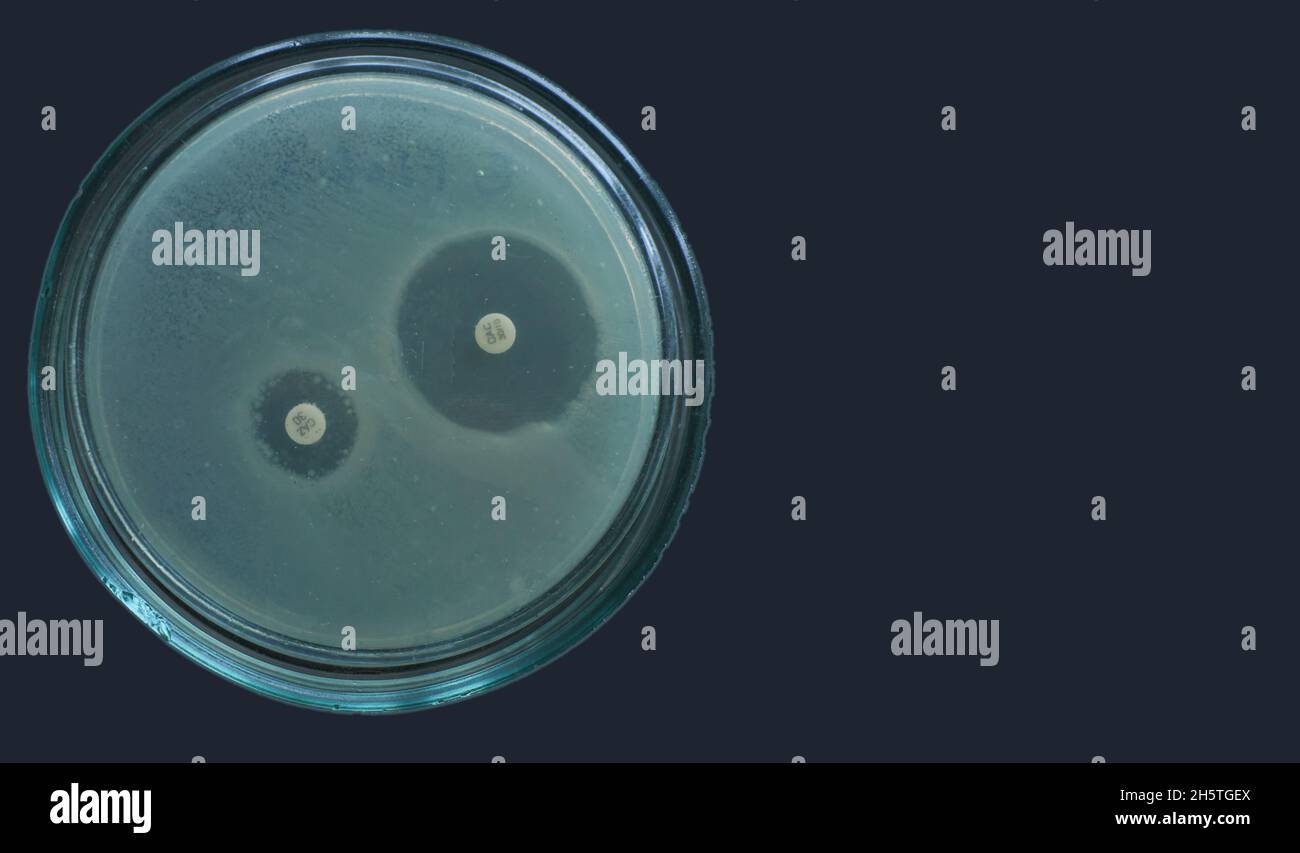 Détection des bêta-lactamases par test de la méthode de diffusion pour Escherichia coli Banque D'Images
