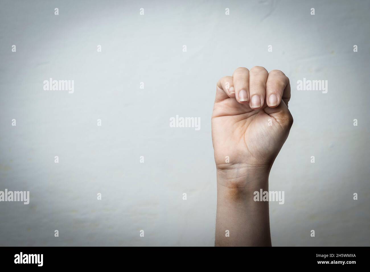 Signal pour l'aide: Femme avec des hématomes sur le bras faire un geste de main pour demander de l'aide silencieusement Banque D'Images