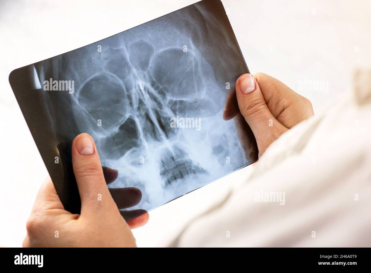 Acquisition par résonance magnétique d'un cerveau humain avec crâne dans les mains du médecin.Examen de la tête par IRM sur fond clair dans un hôpital.Recherche de rayons X pour la défacilité o Banque D'Images