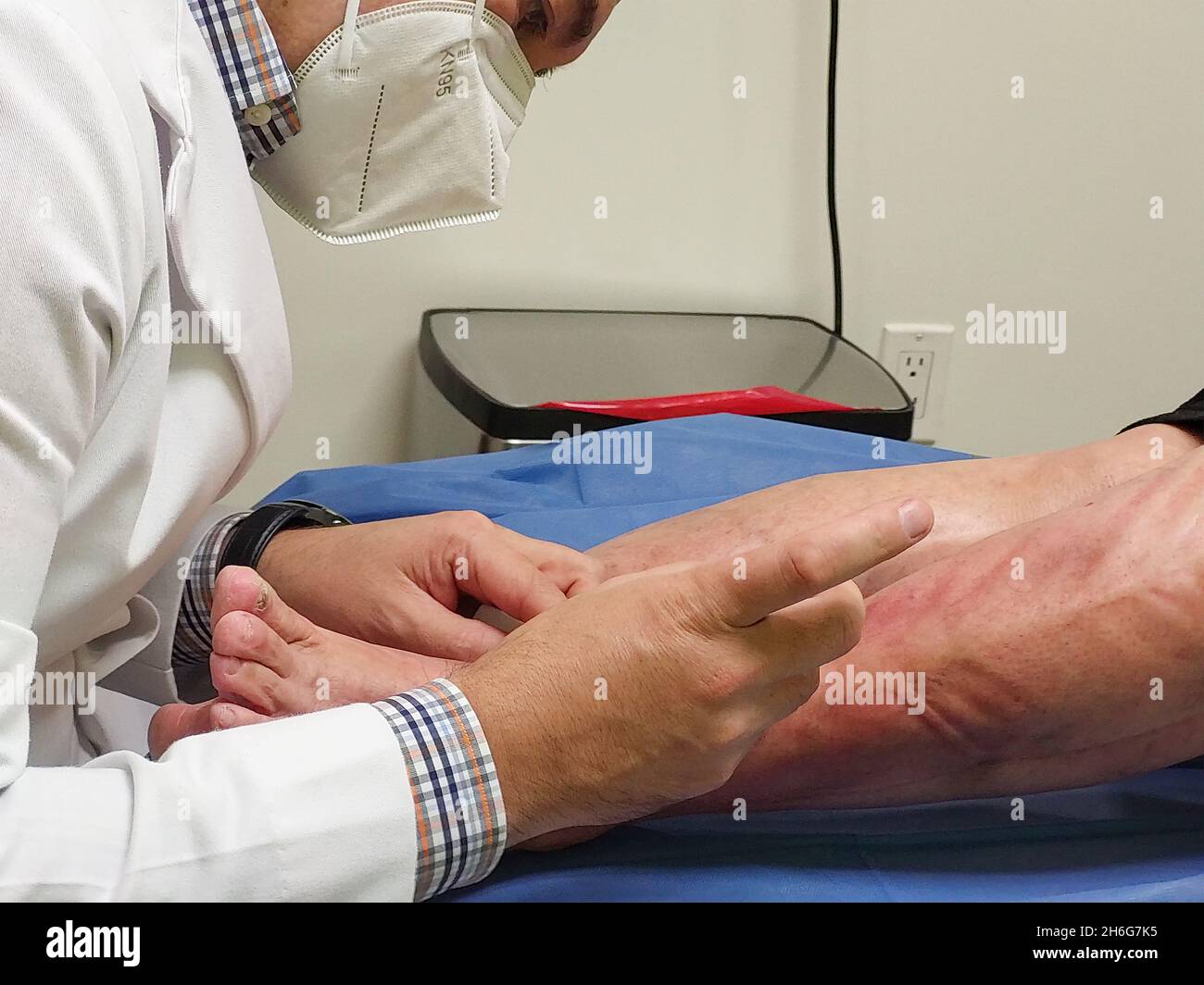 Le médecin effectue une sclérothérapie sur les varices dans les jambes, à l'hôpital un médecin effectue un traitement avec varices, injection. Banque D'Images