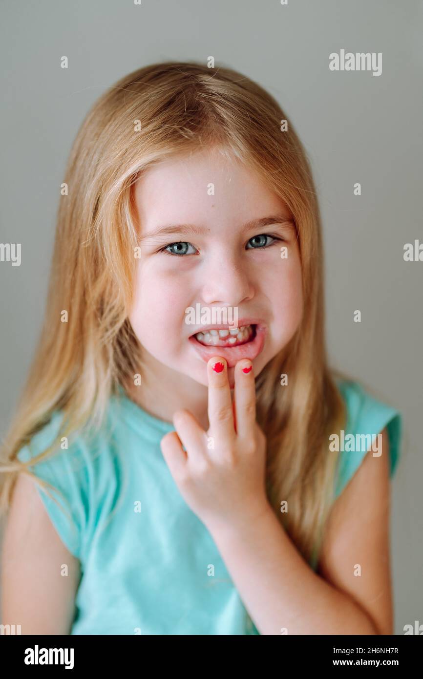 Portrait d'une jeune fille d'âge préscolaire souriant et montrant sa bouche avec une dent de lait tombée.Hygiène dentaire, fée dentaire. Banque D'Images