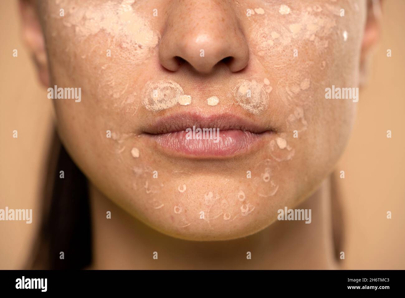 Gros plan de la jeune femme avec le correcteur sur son visage sur un fond beige Banque D'Images