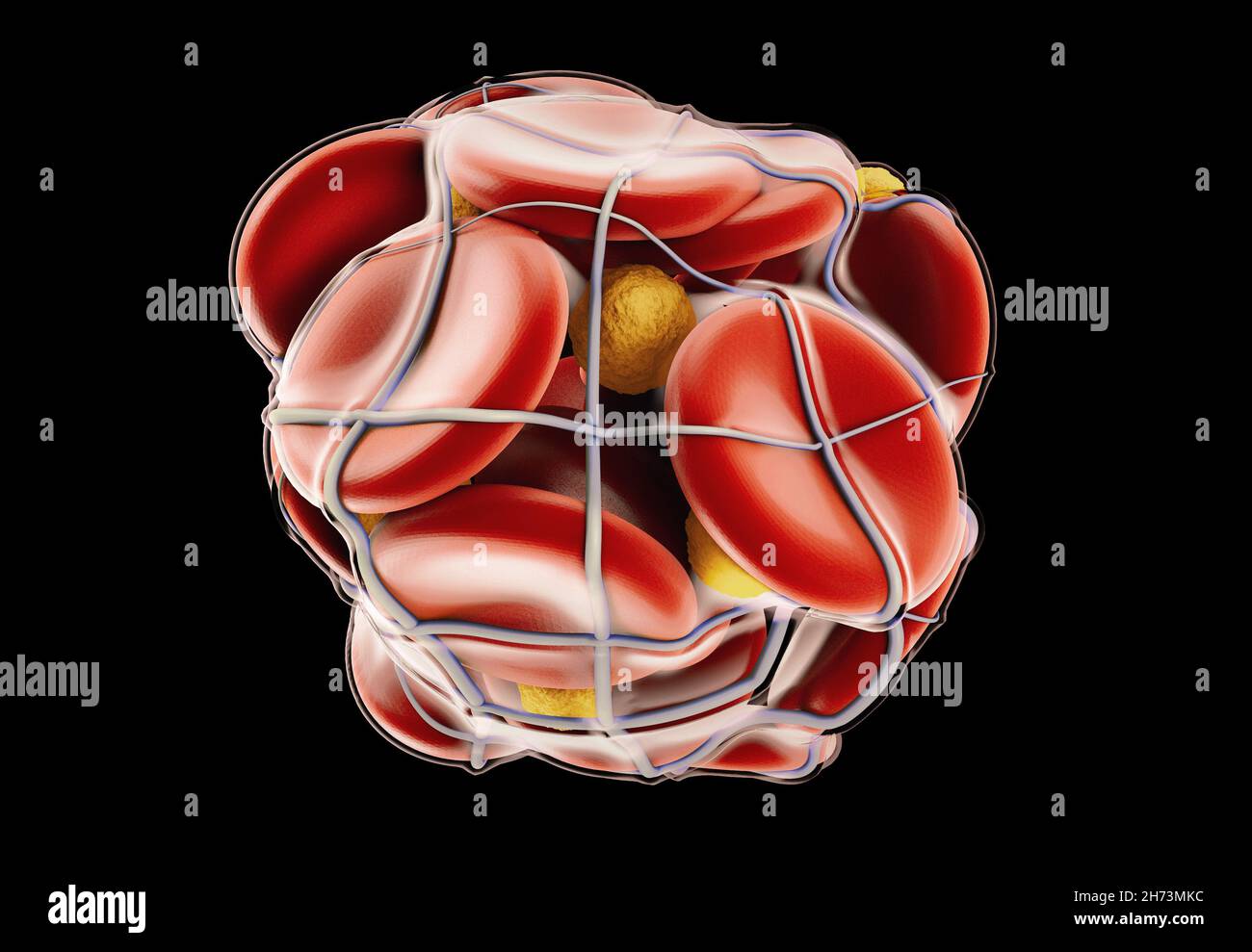 illustration 3d de thrombose veineuse profonde ou de caillots sanguins.Embolie, masque inclus Banque D'Images