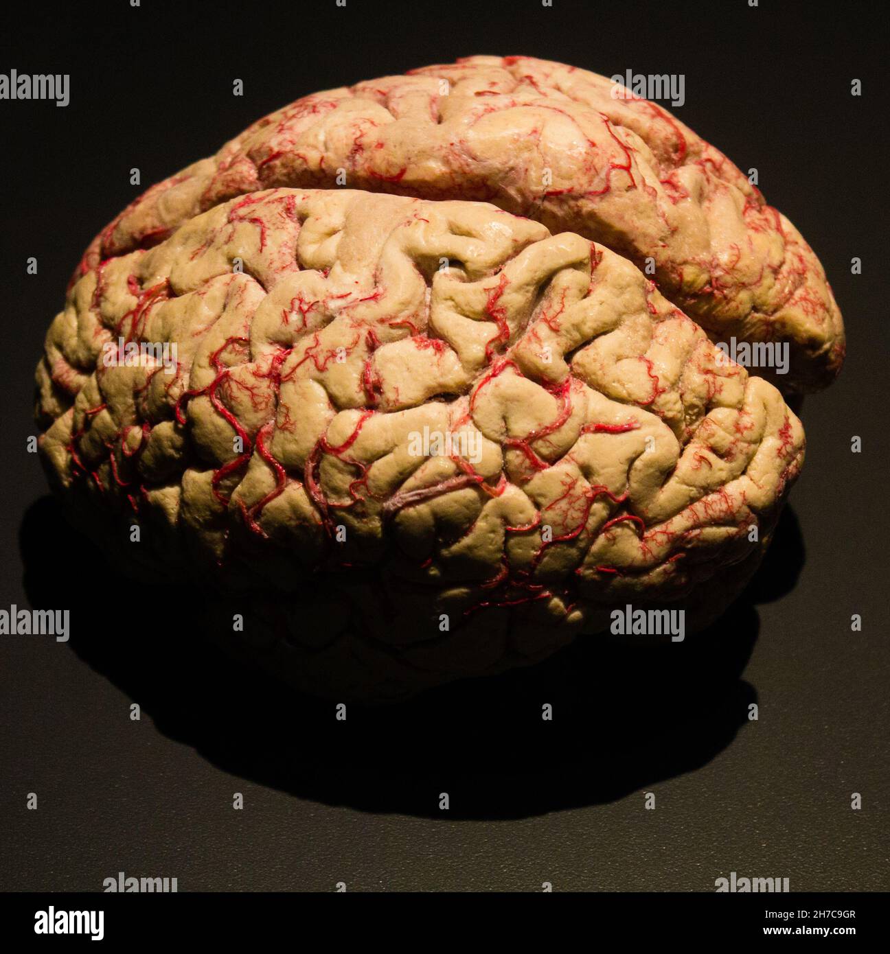 Gros plan d'un cerveau humain plastifié Banque D'Images