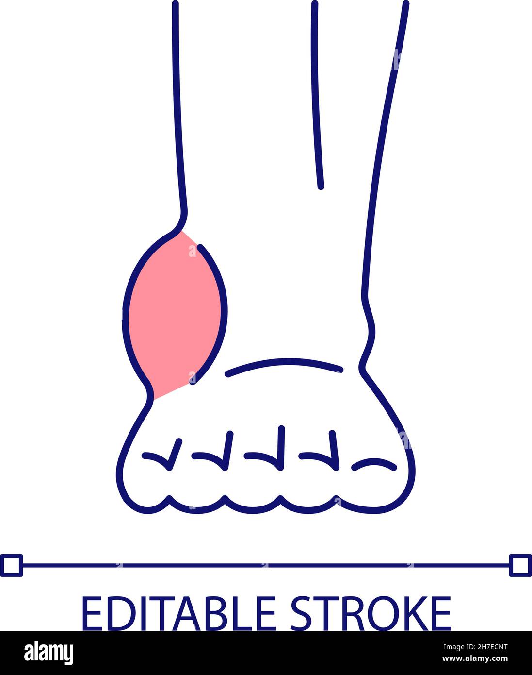 Inflammation de la cheville icône de couleur RVB Illustration de Vecteur