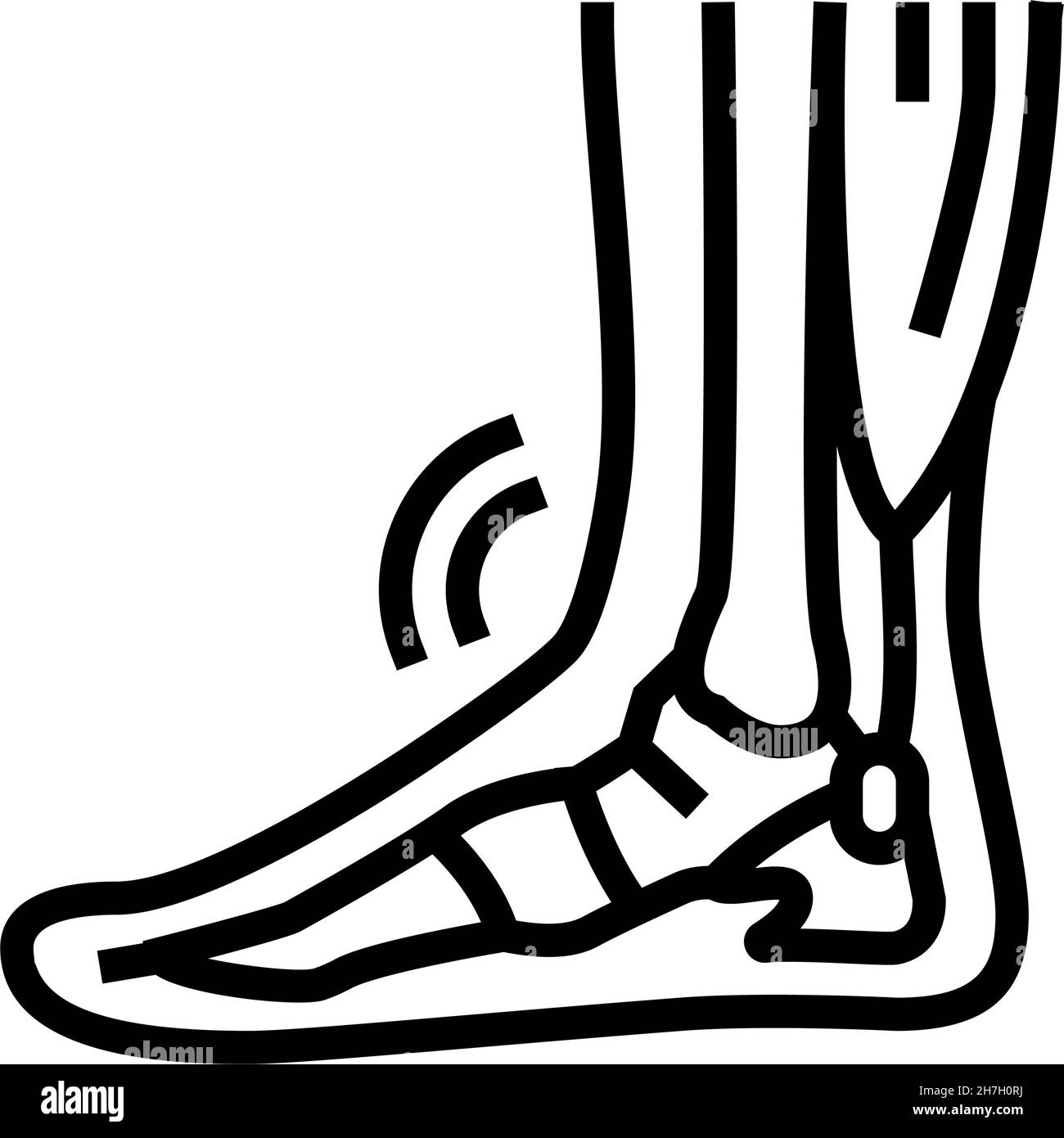 illustration du vecteur de l'icône de ligne de problème de tendonitis Illustration de Vecteur