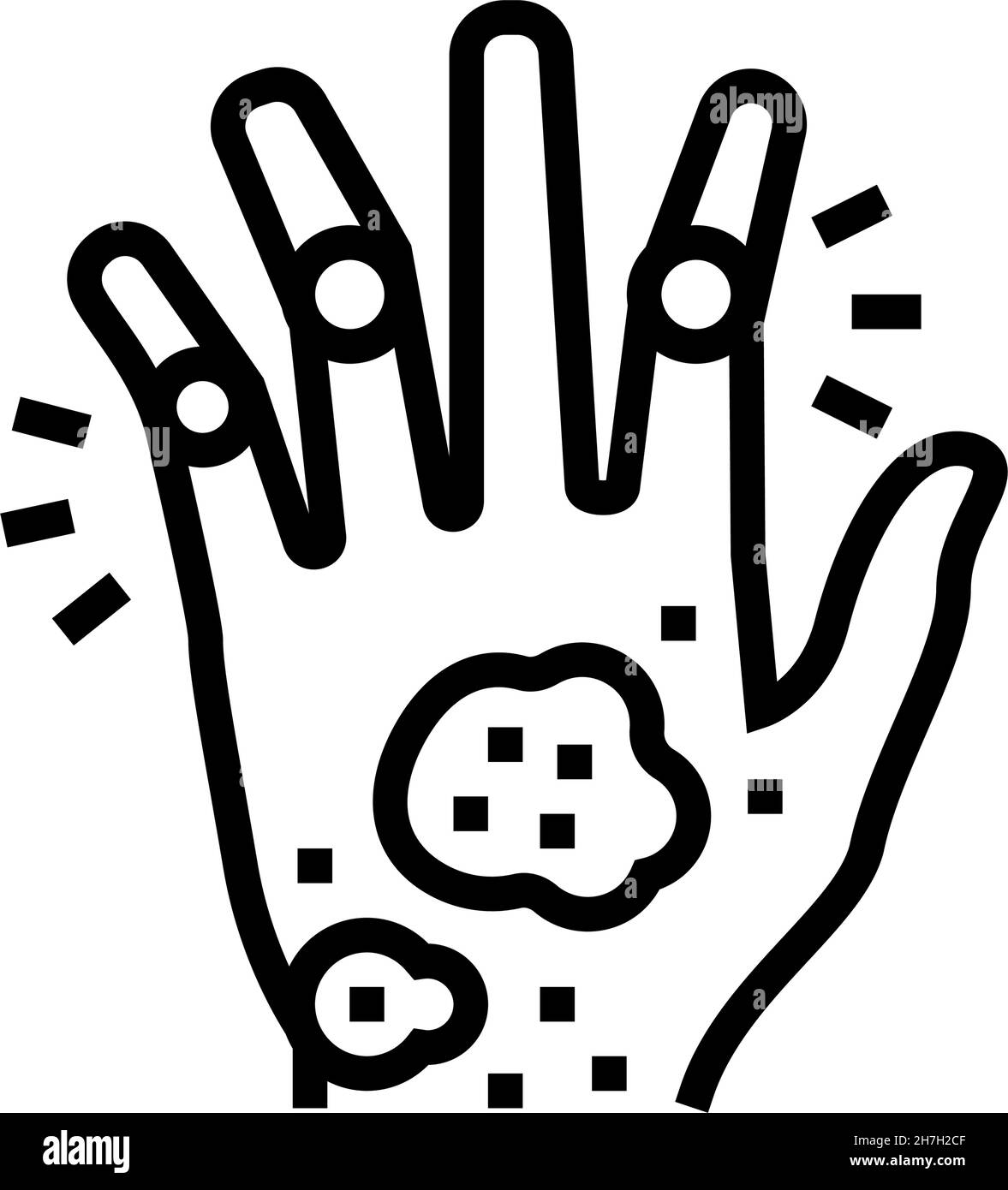 arthrite psoriasique ligne de problème de santé de la peau icône illustration du vecteur Illustration de Vecteur