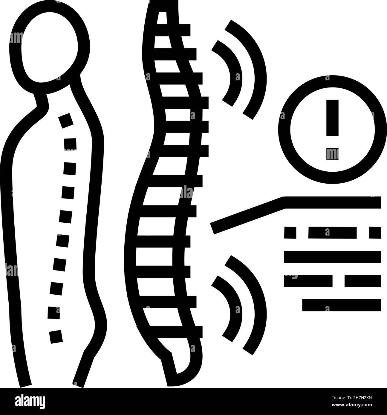 illustration du vecteur de la ligne de problème de santé des spondyloarthropathies Illustration de Vecteur